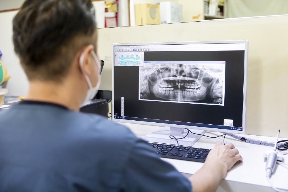 口の中に潜む細菌が引き起こす「むし歯」