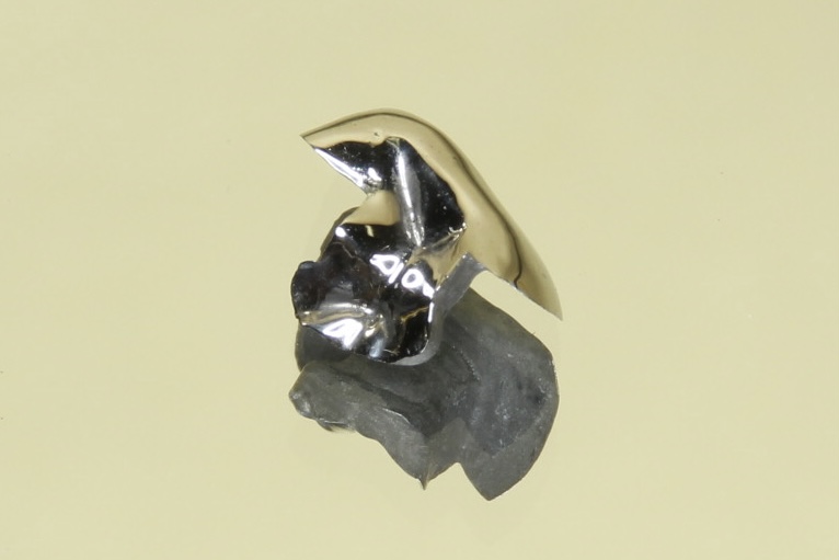 口の中に潜む細菌が引き起こす「むし歯」