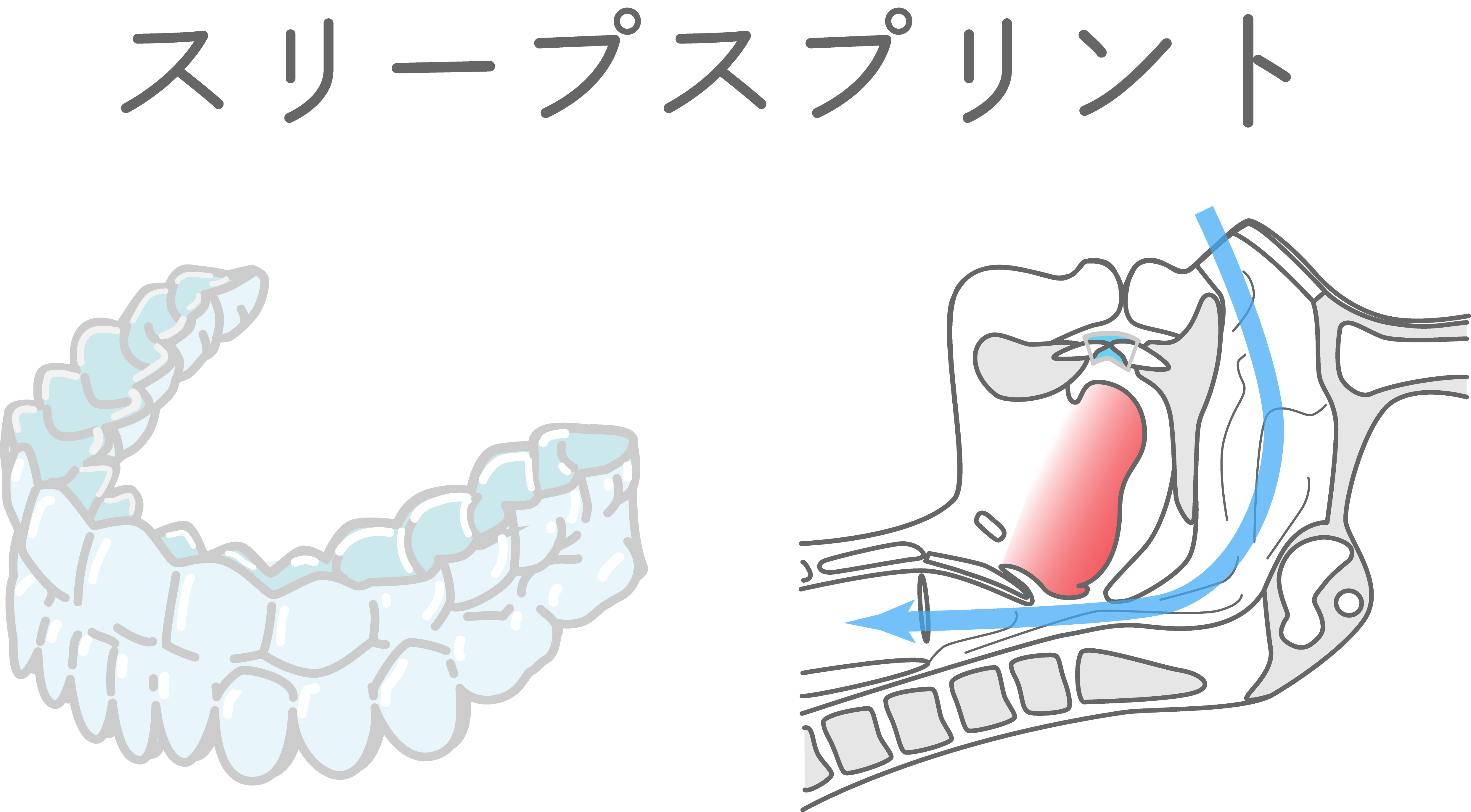 再び食べる喜びと話す楽しみを。入れ歯という選択肢