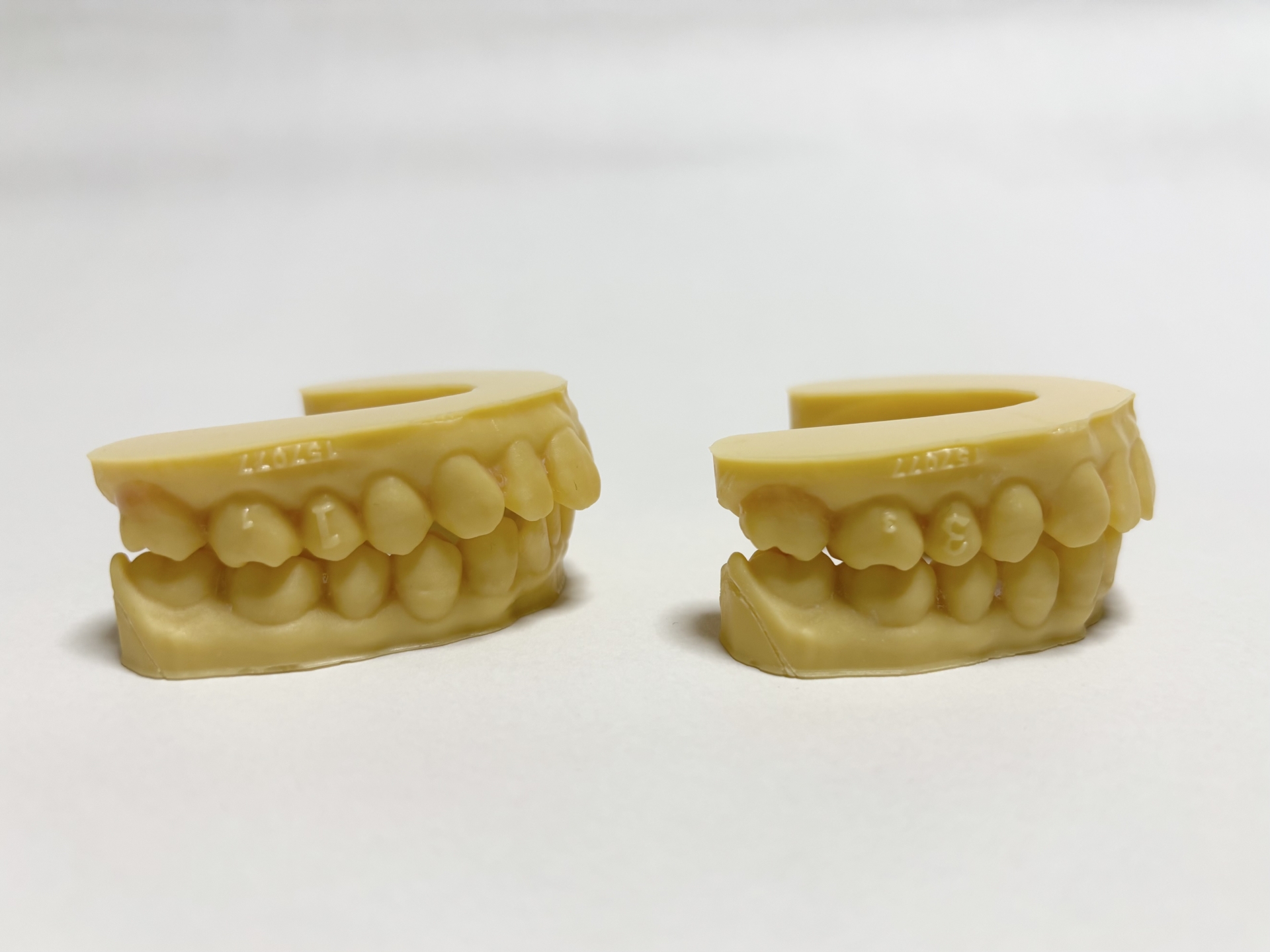 再び食べる喜びと話す楽しみを。入れ歯という選択肢