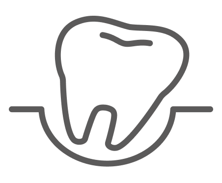 親知らずの抜歯